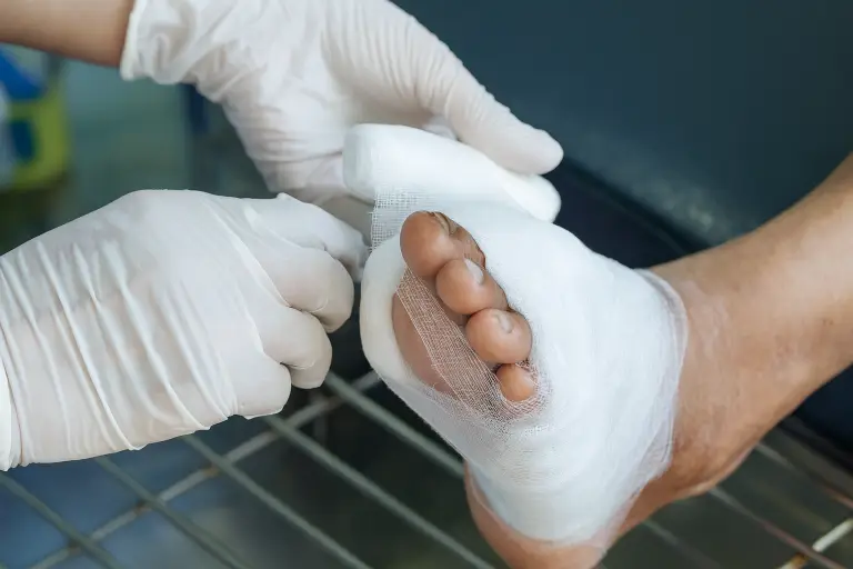 Kisah Inspiratif Kesembuhan Luka Diabetes Seorang Pensiunan