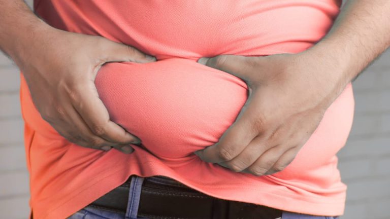 Penyembuhan Luka pada Obesitas: Tantangan dan Mekanisme